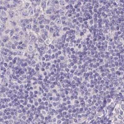 Immunohistochemistry-Paraffin: CHMP5 Antibody [NBP2-48776] - Staining of human lymph node.