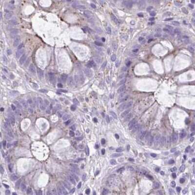 Immunohistochemistry-Paraffin: CHMP5 Antibody [NBP2-48776] - Staining of human colon.