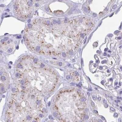Immunohistochemistry-Paraffin: CHMP5 Antibody [NBP2-48776] - Staining of human kidney.