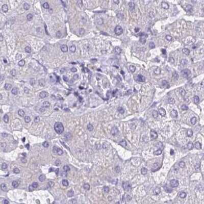 Immunohistochemistry-Paraffin: CHMP5 Antibody [NBP2-48776] - Staining of human liver.