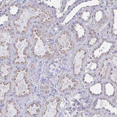 Immunohistochemistry-Paraffin: CHMP5 Antibody [NBP2-49227] - Staining of human kidney shows cytoplasmic positivity in renal tubules.