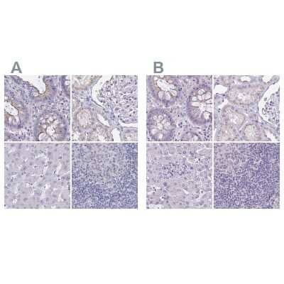 Immunohistochemistry-Paraffin: CHMP5 Antibody [NBP2-49227] - Staining of human colon, kidney, liver and lymph node using Anti-CHMP5 antibody NBP2-49227 (A) shows similar protein distribution across tissues to independent antibody NBP2-48776 (B).