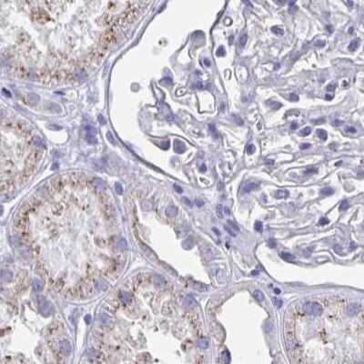 Immunohistochemistry-Paraffin: CHMP5 Antibody [NBP2-49227] - Staining of human kidney.