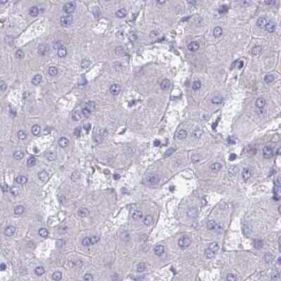 Immunohistochemistry-Paraffin: CHMP5 Antibody [NBP2-49227] - Staining of human liver.