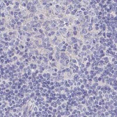 Immunohistochemistry-Paraffin: CHMP5 Antibody [NBP2-49227] - Staining of human lymph node.