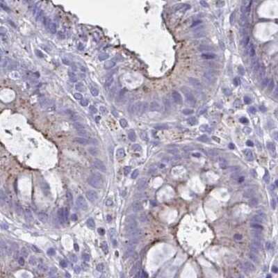 Immunohistochemistry-Paraffin: CHMP5 Antibody [NBP2-49227] - Staining of human colon.