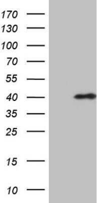 Western Blot: CHMP5 Antibody (OTI5C7) - Azide and BSA Free [NBP2-71937] - Analysis of HEK293T cells were transfected with the pCMV6-ENTRY control (Left lane) or pCMV6-ENTRY CHMP5.