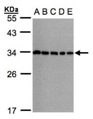 Western Blot: CHMP5 Antibody [NBP1-32597] - Sample(30ug whole cell lysate)A: 293TB: A431  C: H1299D: HeLa S3 E: Hep G2  2% SDS PAGE, antibody diluted at 1:1000.