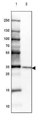 Western Blot CHMP5 Antibody