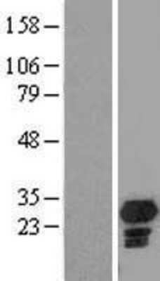 Western Blot CHMP5 Overexpression Lysate