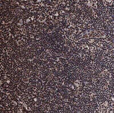 Immunohistochemistry-Paraffin: CHMP7 Antibody [NBP1-81133] - Staining of human lymph node shows strong nuclear positivity in non-germinal center cells.