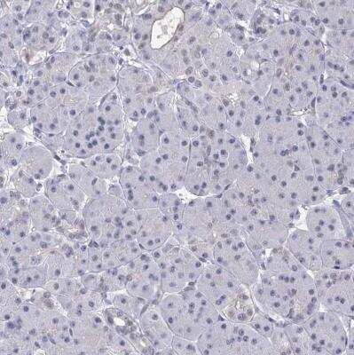 Immunohistochemistry-Paraffin: CHMP7 Antibody [NBP1-81133] - Staining of human pancreas shows no positivity in exocrine glandular cells as expected.