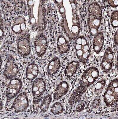 Immunohistochemistry-Paraffin: CHMP7 Antibody [NBP1-81133] - Staining of human duodenum shows strong nuclear positivity in glandular cells.