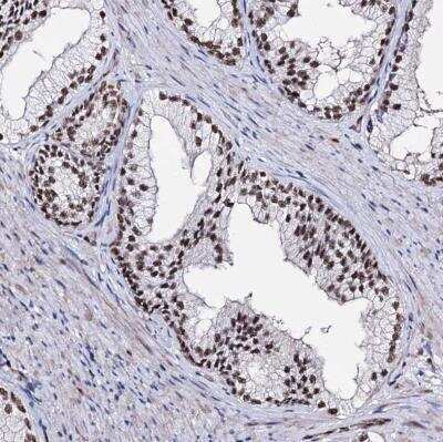 Immunohistochemistry-Paraffin: CHMP7 Antibody [NBP1-81133] - Staining of human prostate shows strong nuclear positivity in glandular cells