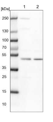 Western Blot: CHMP7 Antibody [NBP1-81133] - Lane 1: NIH-3T3 cell lysate (Mouse embryonic fibroblast cells). Lane 2: NBT-II cell lysate (Rat Wistar bladder tumor cells).