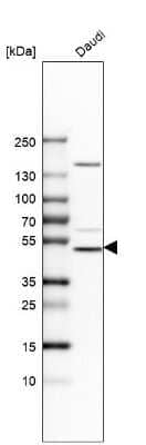 Western Blot: CHMP7 Antibody [NBP1-81133] - Analysis in human cell line Daudi.