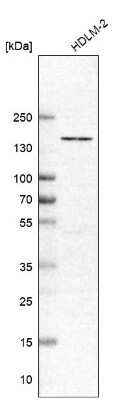 Western Blot: CHMP7 Antibody [NBP1-81133] - Lane 1: Marker [kDa] 207, 110, 79, 49, 32, 25, 17Lane 2: Human cell line RT-4Lane 3: Human cell line EFO-25