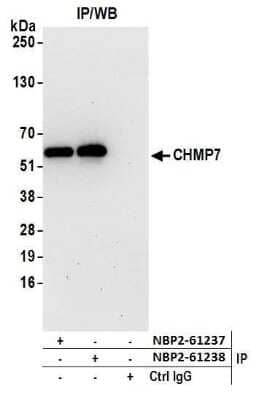 Western Blot: CHMP7 Antibody [NBP2-61237] - Detection of human CHMP7 by western blot of immunoprecipitates. Samples: Whole cell lysate (1.0 mg per IP reaction; 20% of IP loaded) from 293T cells prepared using NETN lysis buffer. Antibodies: Affinity purified rabbit anti-CHMP7 antibody NBP2-61237 used for IP at 20 ul per reaction. CHMP7 was also immunoprecipitated by rabbit anti-CHMP7 antibody NBP2-61238. For blotting immunoprecipitated CHMP7, NBP2-61237 was used at 1:250. Detection: Chemiluminescence with an exposure time of 30 seconds.