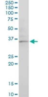 Western Blot: CHN 1 Antibody (3A3) [H00001123-M03] - Analysis of CHN1 expression in NIH/3T3 (Cat # L018V1).