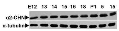 Western Blot: CHN 1 Antibody [NBP1-58326] - Expression of CHN1 in mouse brain during embryonic and early postnatal development. Image from verified customer review.