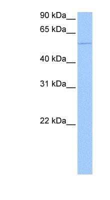 Western Blot: CHN 1 Antibody [NBP1-58326] - Jurkat cell lysate, concentration 0.2-1 ug/ml.