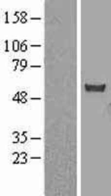 Western Blot: CHN 1 Overexpression Lysate (Adult Normal) [NBL1-09164] Left-Empty vector transfected control cell lysate (HEK293 cell lysate); Right -Over-expression Lysate for CHN 1.