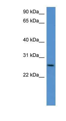 Western Blot: CHODL Antibody [NBP1-79543] - Mouse Kidney lysate, concentration 0.2-1 ug/ml.