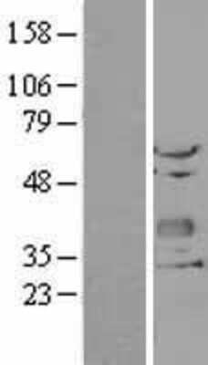 Western Blot: CHODL Overexpression Lysate (Adult Normal) [NBL1-09167] Left-Empty vector transfected control cell lysate (HEK293 cell lysate); Right -Over-expression Lysate for CHODL.