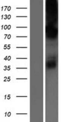 Western Blot: CHPT1 Overexpression Lysate (Adult Normal) [NBP2-06672] Left-Empty vector transfected control cell lysate (HEK293 cell lysate); Right -Over-expression Lysate for CHPT1.