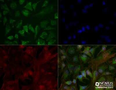 Immunocytochemistry/Immunofluorescence: CHREBP Antibody (2D9NB) - Azide and BSA Free [NBP2-80669] - HeLa cells were fixed for 10 minutes using 10% formalin and then permeabilized for 5 minutes using 1X TBS + 0.5% Triton X-100. The cells were incubated with CHREBP (2D9NB) at a 1:100 dilution overnight at 4C and detected with DyLight 488 (Green) at a 1:500 dilution. Actin was detected with Phalloidin 568 (Red) at a 1:200 dilution. Nuclei were detected with DAPI (Blue) at 2.0 ug/ml in 1X PBS. Cells were imaged using a 40X objective. Image from the standard format of this antibody.