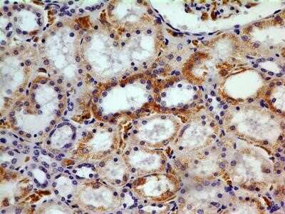 Immunohistochemistry-Paraffin: CHREBP Antibody (2D9NB) - Azide and BSA Free [NBP2-80669] - Analysis of a FFPE tissue section of normal human kidney using 1:200 dilution of CHREBP antibody (clone 2D9NB). The antibody generated a diffused to punctate staining pattern mainly in the cytoplasm (but in some nuclei also) of cuboidal epithelial cells o