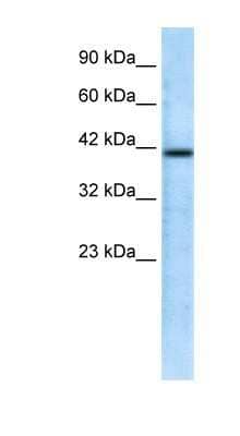 Western Blot: CHRFAM7A Antibody [NBP1-80091] - Titration: 0.2-1 ug/ml, Positive Control: Jurkat cell lysate.