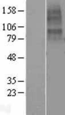 Western Blot: CHRNA10 Overexpression Lysate (Adult Normal) [NBL1-09178] Left-Empty vector transfected control cell lysate (HEK293 cell lysate); Right -Over-expression Lysate for CHRNA10.