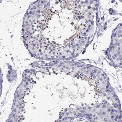 Immunohistochemistry-Paraffin: CHRNB3 Antibody [NBP1-91783] - Staining of human testis shows moderate cytoplasmic positivity in cells in seminiferous ducts.