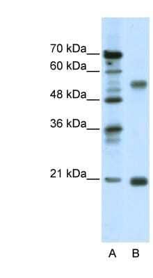 Western Blot: CHRNB3 Antibody [NBP1-79950] - Jurkat cell lysate, concentration 0.03ug/ml.