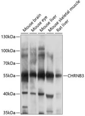 Western Blot CHRNB3 Antibody - BSA Free