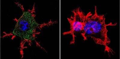 Immunocytochemistry/Immunofluorescence: CHRND Antibody (88B) [NB120-2804] - Analysis of Nicotinic Acetylcholine Receptor using Anti-Nicotinic Acetylcholine Receptor Monoclonal Antibody (88B) shows staining in Neuro-2a Cells. Nicotinic Acetylcholine Receptor staining (green), F-Actin staining with Phalloidin (red) and nuclei with DAPI (blue) is shown. Cells were grown on chamber slides and fixed with formaldehyde prior to staining. Cells were probed without (control) or with or an antibody recognizing Nicotinic Acetylcholine Receptor at a dilution of 1:100 over night at 4C, washed with PBS and incubated with a DyLight-488 conjugated.