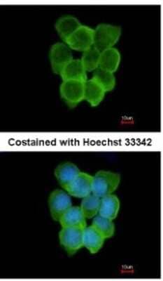Immunocytochemistry/Immunofluorescence: CHRND Antibody [NBP1-31248] - Analysis of methanol-fixed A431, using antibody at 1:200 dilution.