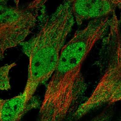 Immunocytochemistry/Immunofluorescence: CHRND Antibody [NBP2-68725] - Staining of human cell line HeLa shows localization to nucleoplasm & plasma membrane.