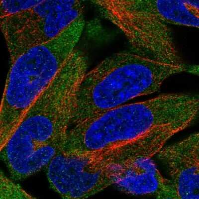 Immunocytochemistry/Immunofluorescence: CHRND Antibody [NBP2-68832] - Staining of human cell line RH-30 shows localization to plasma membrane.