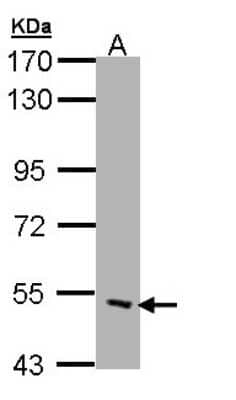 Western Blot CHRND Antibody - BSA Free