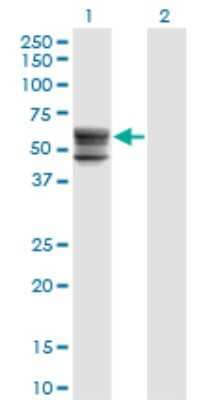 Western Blot: CHST12 Antibody (3D6) [H00055501-M01] - Analysis of CHST12 expression in transfected 293T cell line by CHST12 monoclonal antibody (M01), clone 3D6.Lane 1: CHST12 transfected lysate (Predicted MW: 48.4 KDa).Lane 2: Non-transfected lysate.