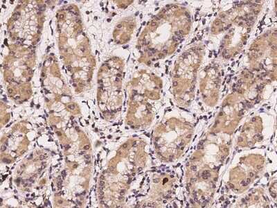 Immunohistochemistry-Paraffin: CHST12 Antibody [NBP2-97234] - Immunochemical staining of human CHST12 in human stomach with rabbit polyclonal antibody at 1:100 dilution, formalin-fixed paraffin embedded sections.