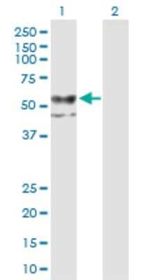Western Blot: CHST12 Antibody [H00055501-B01P] - Analysis of CHST12 expression in transfected 293T cell line by CHST12 polyclonal antibody.  Lane 1: CHST12 transfected lysate(45.54 KDa). Lane 2: Non-transfected lysate.