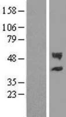 Western Blot: CHST12 Overexpression Lysate (Adult Normal) [NBL1-09194] Left-Empty vector transfected control cell lysate (HEK293 cell lysate); Right -Over-expression Lysate for CHST12.