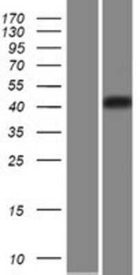 Western Blot: CHST5 Overexpression Lysate (Adult Normal) [NBP2-06323] Left-Empty vector transfected control cell lysate (HEK293 cell lysate); Right -Over-expression Lysate for CHST5.