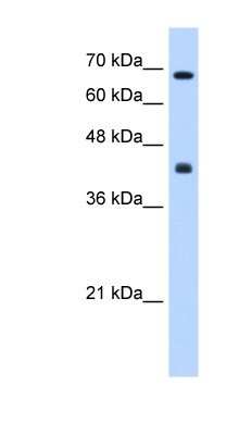 Western Blot: CHST8 Antibody [NBP1-62239] - HepG2 cell lysate, concentration 0.2-1 ug/ml.