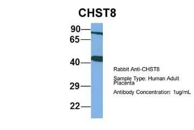 Western Blot: CHST8 Antibody [NBP1-62239] - Sample Type: Human Adult Placenta Antibody Dilution: 1.0 ug/ml