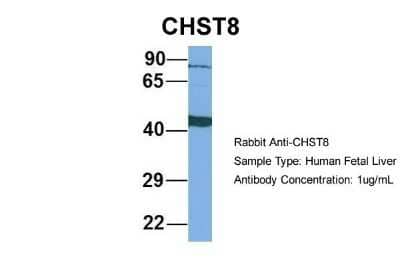 Western Blot: CHST8 Antibody [NBP1-62239] - Sample Type: Human Fetal Liver Antibody Dilution: 1.0 ug/ml