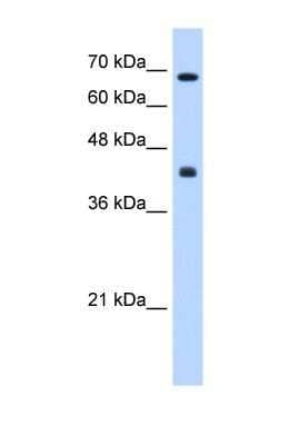 Western Blot: CHST8 Antibody [NBP1-69273] - This Anti-CHST8 antibody was used in Western Blot of HepG2 tissue lysate at a concentration of 0.25ug/ml.